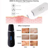 Ultrasonic Face Cleaning Machine Skin Scrubber
