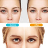 Portable Anti-Aging Eyes Massager