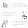 Ear Candle Wax Removal