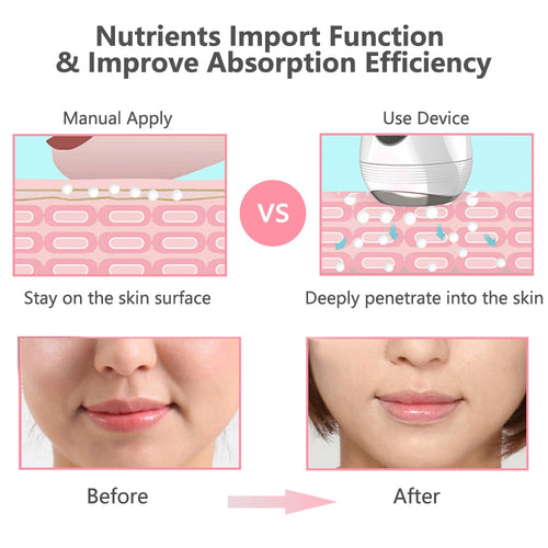 Mini Microcurrent Face Lift Devices Skin Tightening