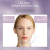ANLAN RF Lifting Facial Mesotherapy