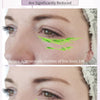ANLAN RF Lifting Facial Mesotherapy