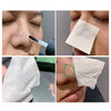 BREYLEE Tea Tree Blackhead Remover Serum