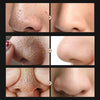 BREYLEE Tea Tree Blackhead Remover Serum