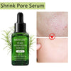 BREYLEE Tea Tree Blackhead Remover