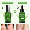 BREYLEE Tea Tree Blackhead Remover Serum
