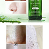 BREYLEE Tea Tree Blackhead Remover