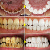 RtopR Teeth Whitening Serum