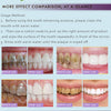 RtopR Teeth Whitening Serum
