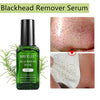 BREYLEE Tea Tree Blackhead Remover