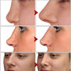 Natural Nose Up Heighten Rhinoplasty Essential Oil