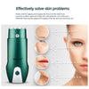 CkeyiN Mini Hifu Focused Facial Massager